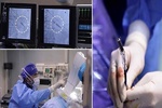 کوچک ترین پیس میکر جهان در بیمارستان قلب شهید رجایی تعبیه شد