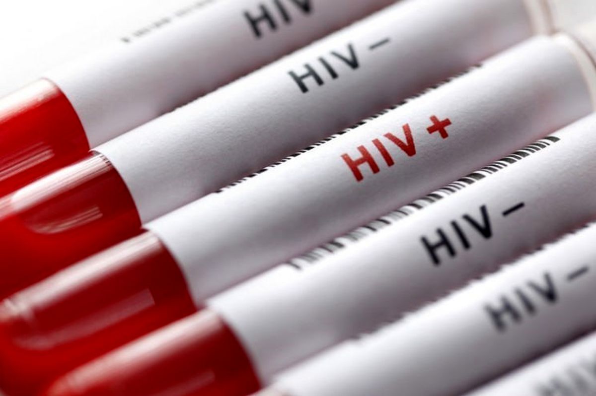 سرعت ابتلا به HIV در زنان ایرانی بیشتر از مردان است